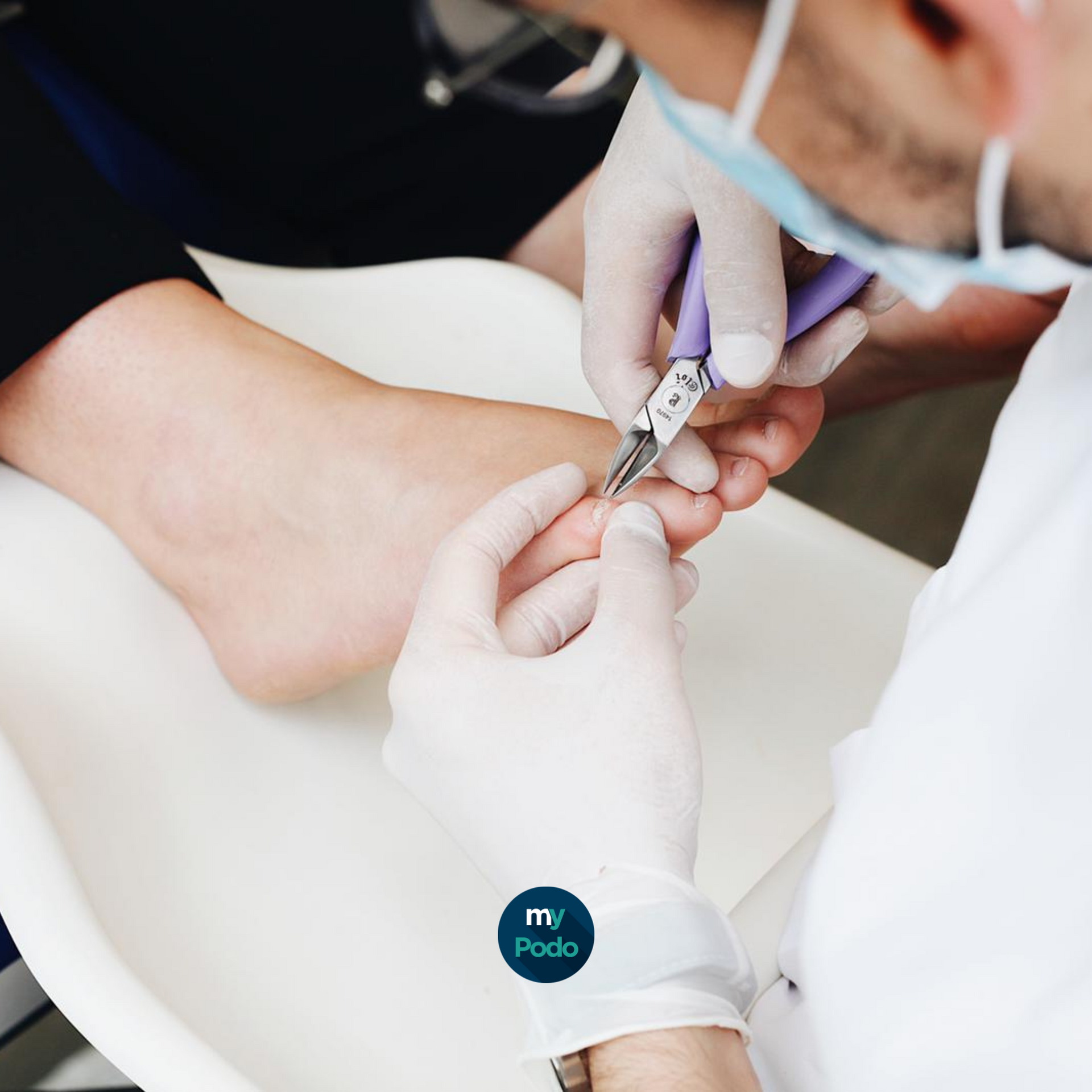 Pinces-à-Ongles My Podologie