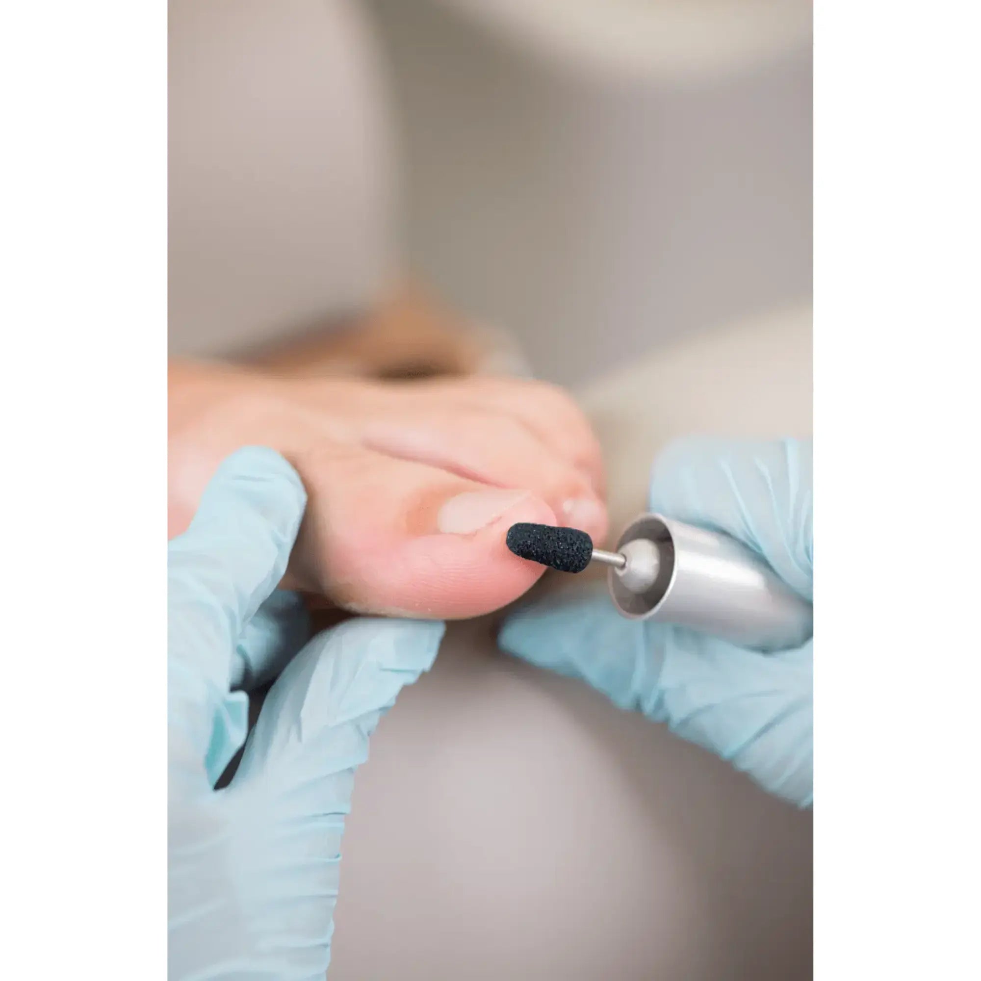 Capuchons abrasifs coniques x10 1503 - Diamant - Grain gros - Abrasion des cors, durillons et hyperkératoses - 5 mm Ruck