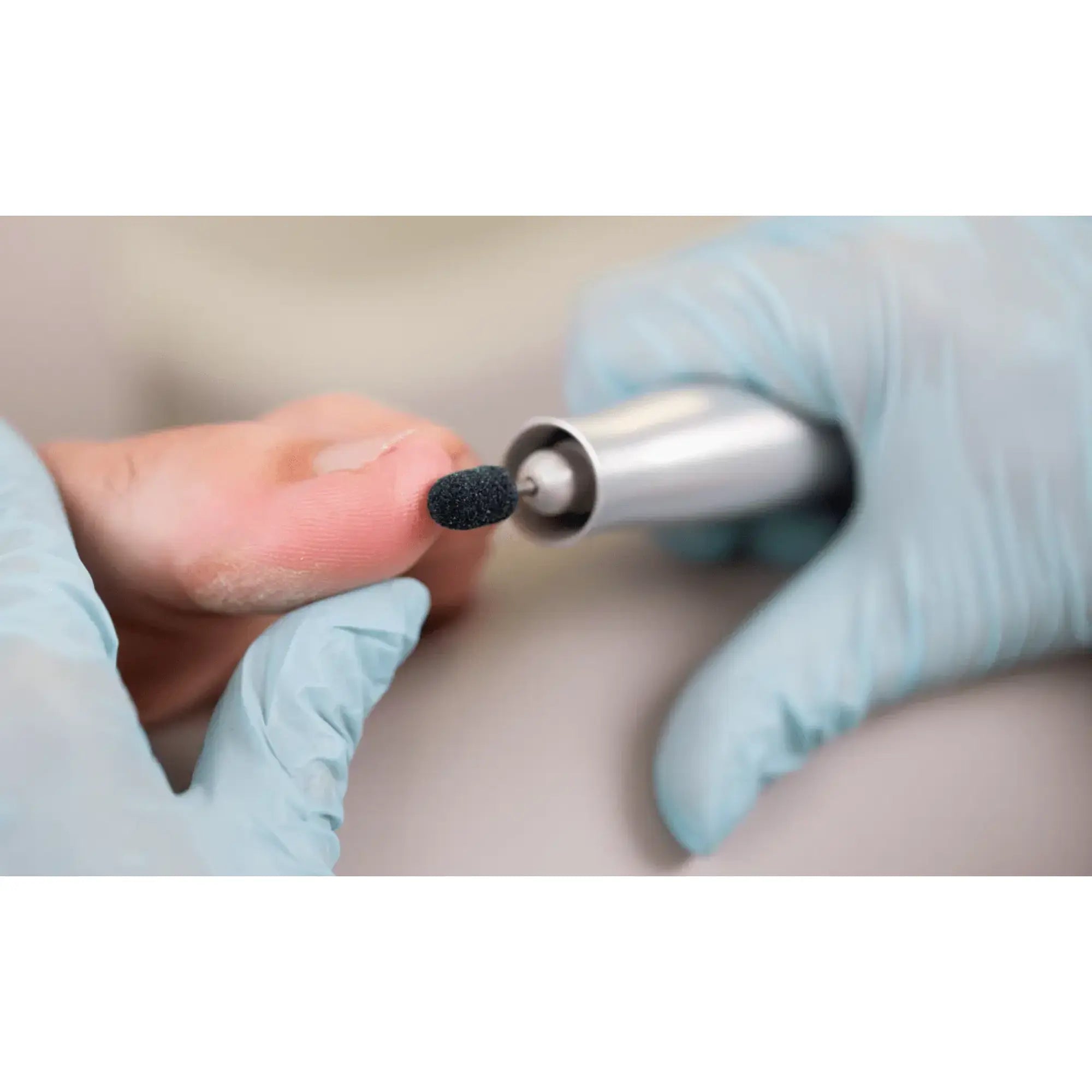 Capuchons abrasifs ronds x10 0203 - Diamant - Grain gros - Abrasion des cors, durillons et hyperkératoses - 10 mm Ruck