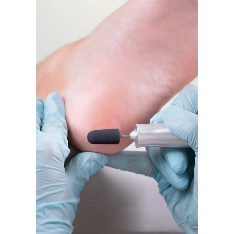 Capuchons abrasifs ronds x10 0501 - Diamant - Grain fin - Abrasion des cors, durillons et hyperkératoses - 13 mm Ruck