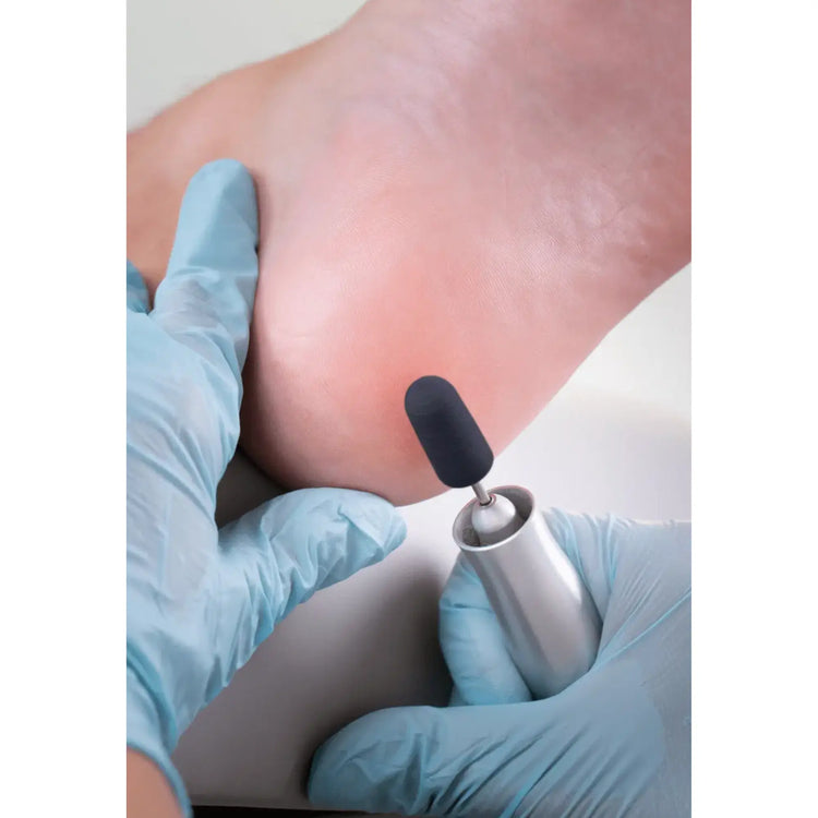 Capuchons abrasifs ronds x10 0501 - Diamant - Grain fin - Abrasion des cors, durillons et hyperkératoses - 13 mm Ruck