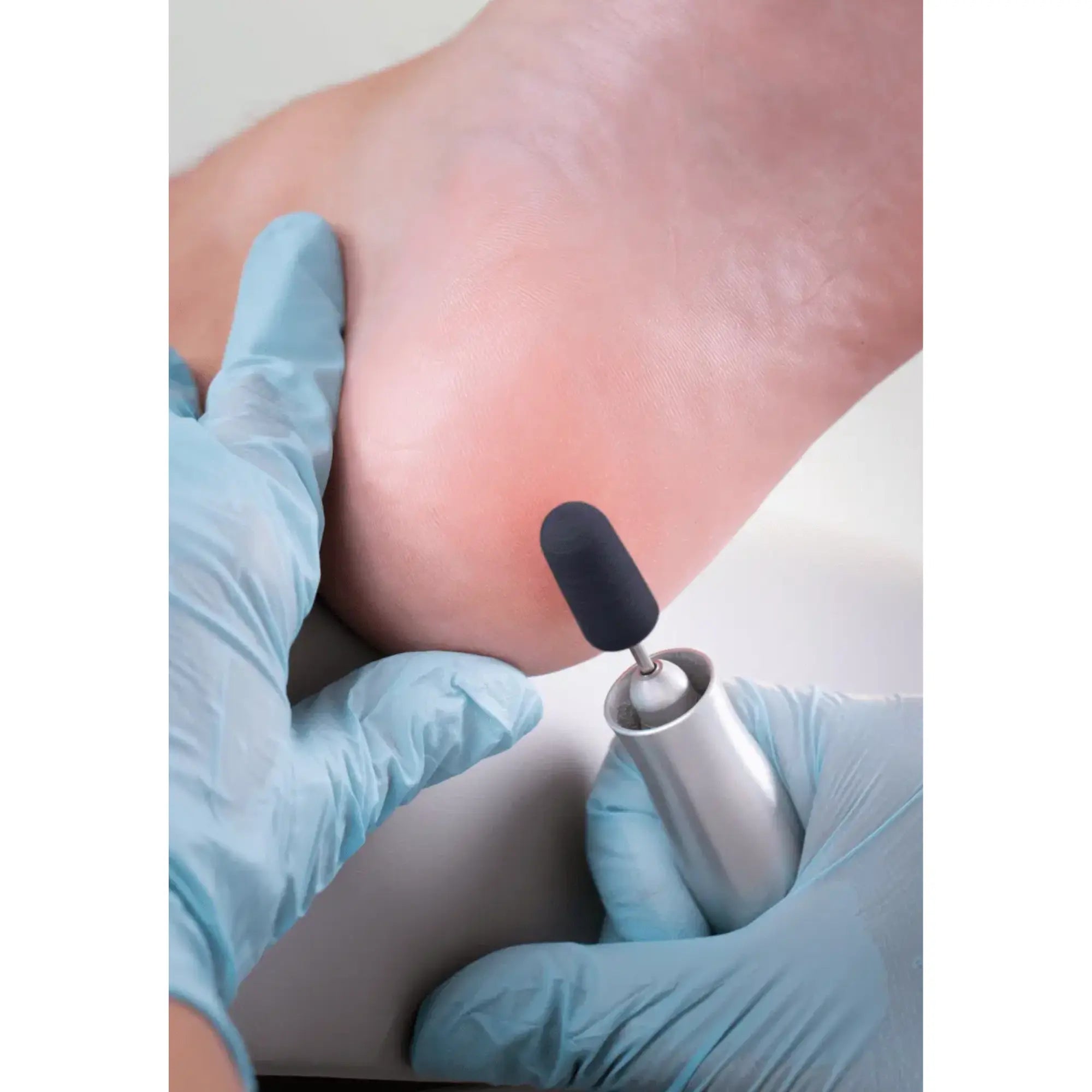 Capuchons abrasifs ronds x10 1303 - Diamant - Grain gros - Abrasion des cors, durillons et hyperkératoses - 5 mm Ruck