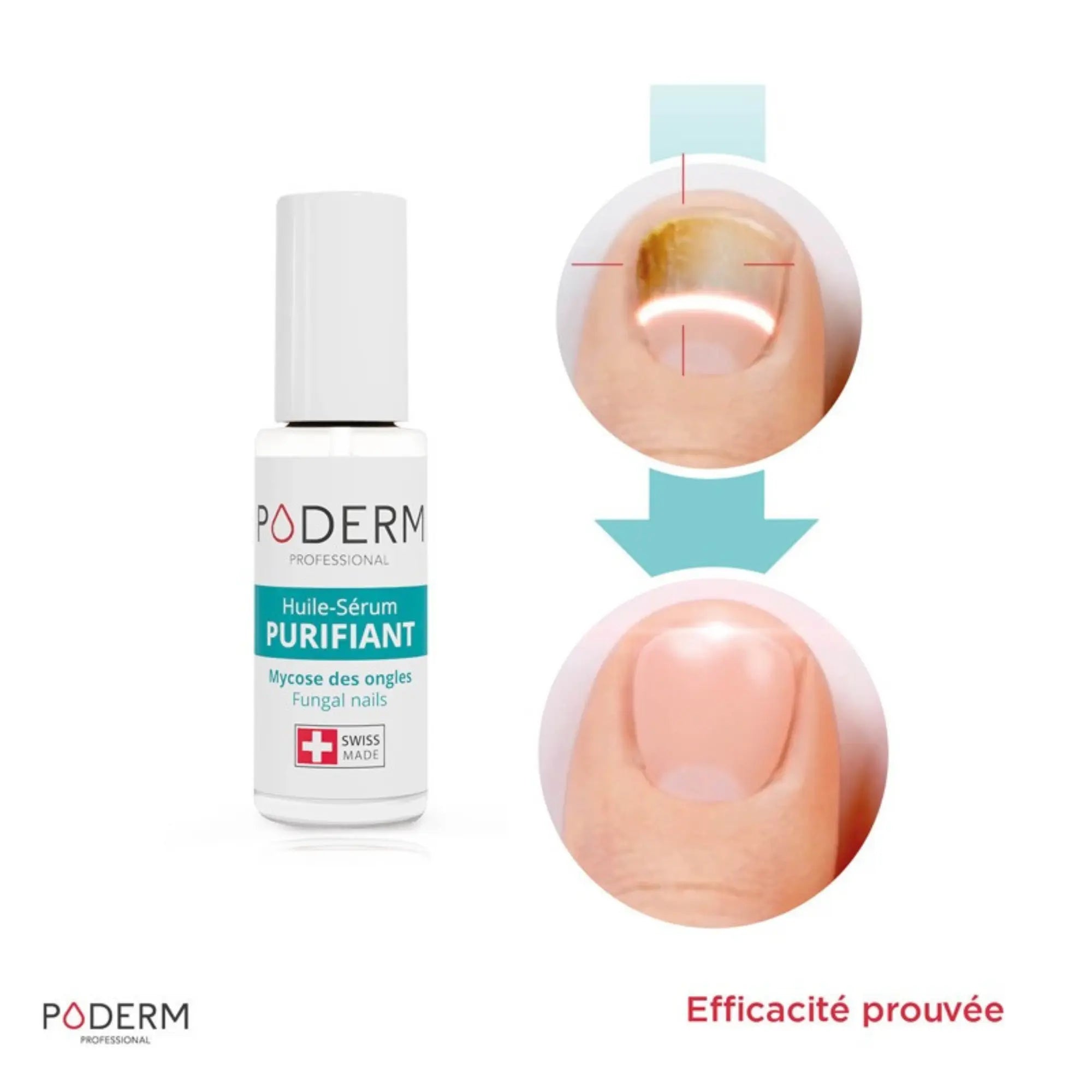 Pack Traitement Sérum Purifiant (8 ml) + Booster (6 ml) - Poderm Professional