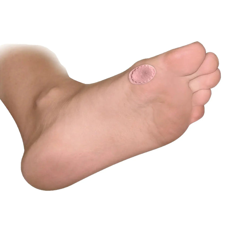 Patchs protecteurs en feutre adhésif - Forme ovale - Paquet de 9 pièces - My Podologie