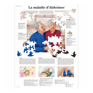 Planche anatomique - La maladie d'Alzheimer - Anatomie et pathologie - My Podologie
