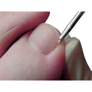 Protecteurs Sulci - 100 pièces - Ruck Ruck