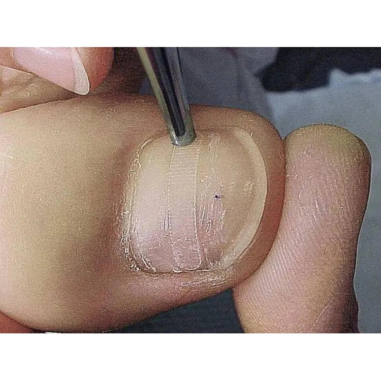 Languettes B/S Classiques  x10 - My Podologie