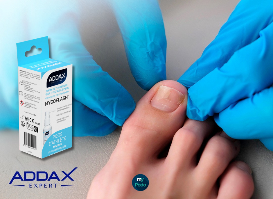 Onychomycose : Addax grands gagnants selon AlloPodo !