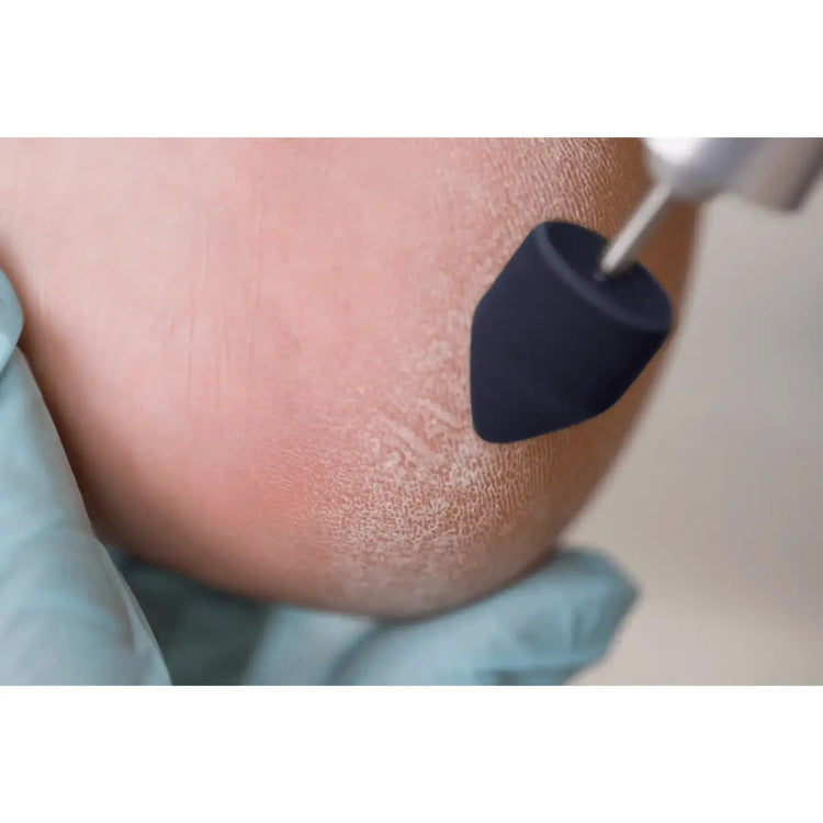 Pointed abrasive caps x10 1001 - Diamond - Fine grain - Abrasion of corns, calluses and hyperkeratoses - 10 mm Ruck 