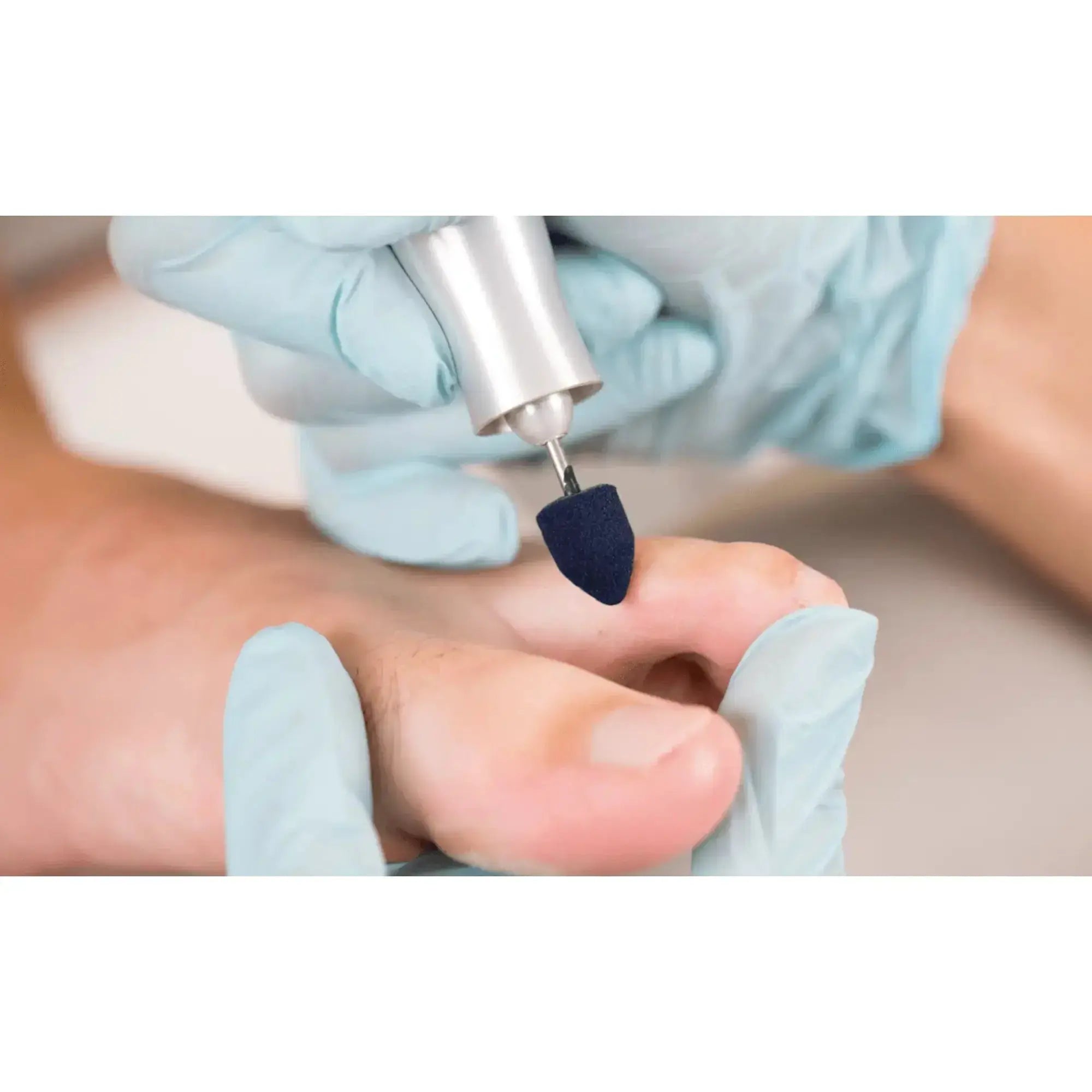 Pointed abrasive caps x10 1001 - Diamond - Fine grain - Abrasion of corns, calluses and hyperkeratoses - 10 mm Ruck 