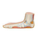 Squelette d'un pied plat (Pes Planus)